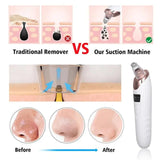 Face Vacuum Suction